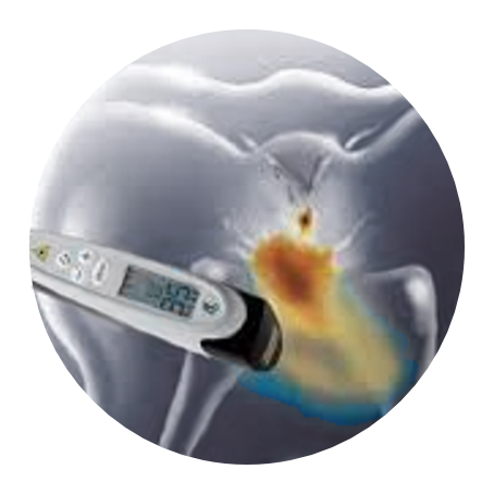 Laser-Fluoreszensdiagnostik Laser-Fluoreszenzdiagnostik